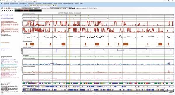 18. ábra. Síndiagnosztikai mérési adatok megjelenése a Páter rendszerben
